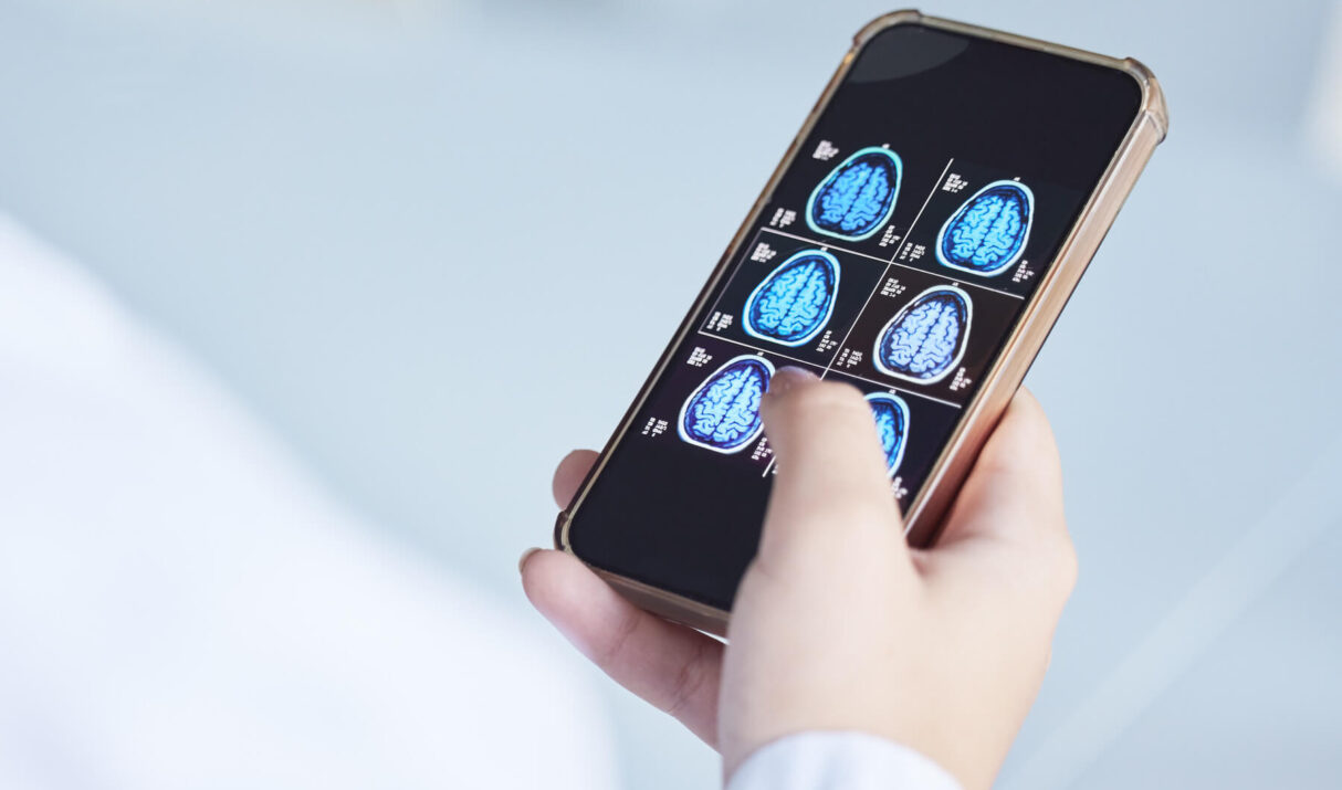 Can your cell phone cause brain cancer?